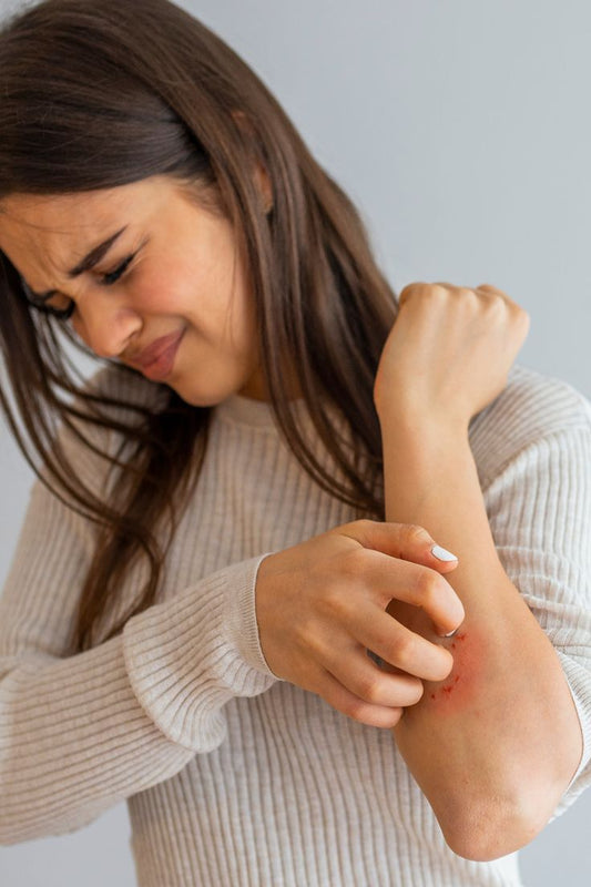 Eczema infected women  scratching her hand