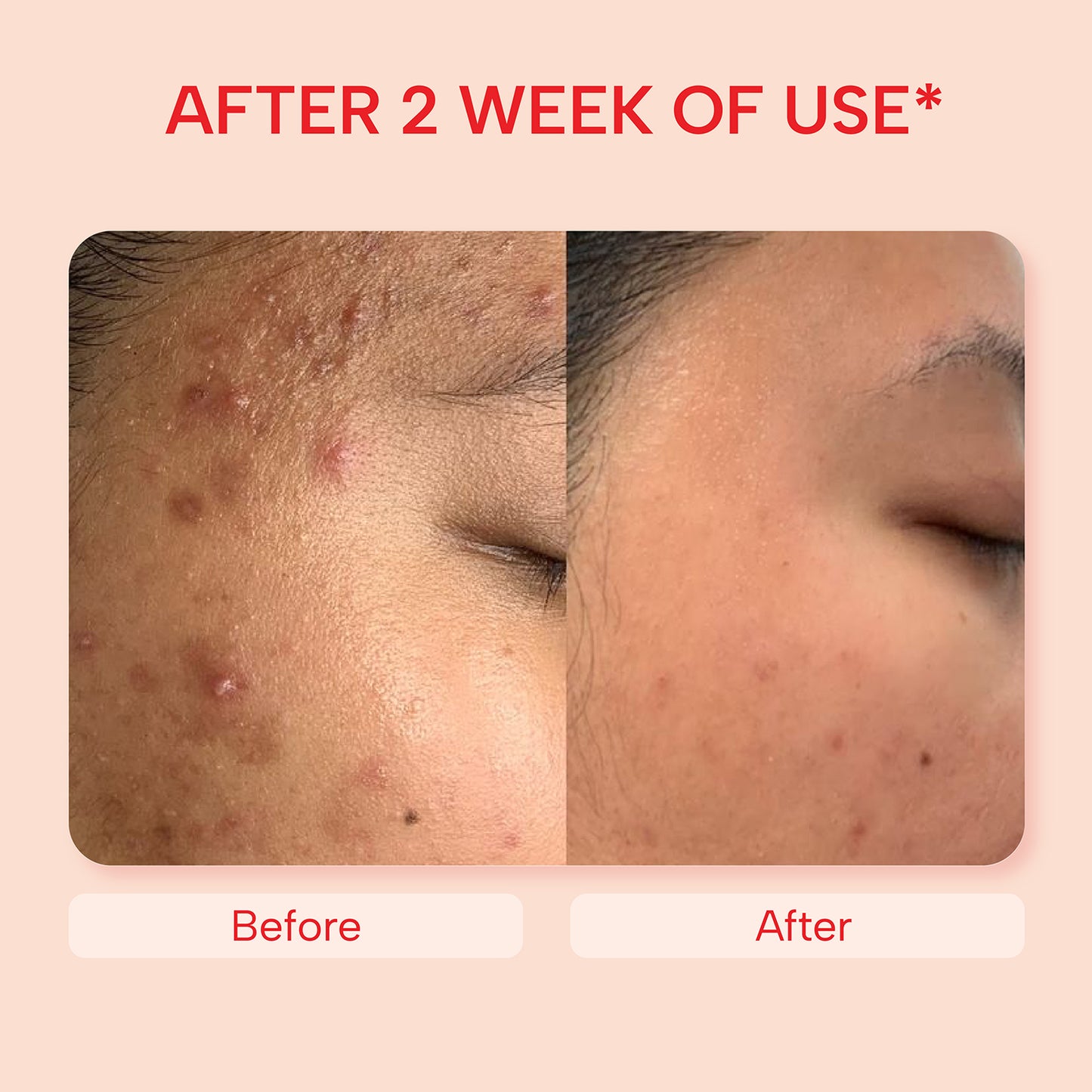 Skin Repair